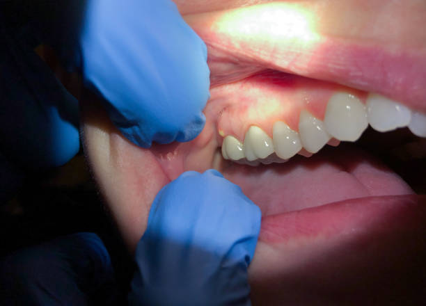 Best Emergency Cosmetic Dentistry (e.g., broken veneers) in Michigan City, IN